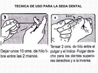 TECNICA DE USO PARA LA SEDA DENTAL
 
