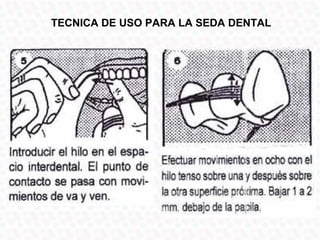 TECNICA DE USO PARA LA SEDA DENTAL
 