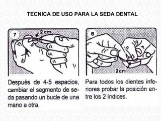 TECNICA DE USO PARA LA SEDA DENTAL
 
