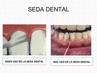 SEDA DENTAL




BUEN USO DE LA SEDA DENTAL   MAL USO DE LA SEDA DENTAL
 