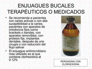 ENJUAGUES BUCALES
 TERAPÉUTICOS O MEDICADOS
• Se recomienda a pacientes
  con caries activas o con alta
  suceptibilidad a la caries,
  pacientes con aparatos de
  ortodoncia fijos como
  brackets o bandas, con
  aparatos removibles, con
  prótesis fija, implantes
  dentales, después de una
  cirugía o con reducción del
  flujo salivar
• El enjuague antimicrobiano
  mas utilizado es el que
  contiene clorhexidina al
  0.12%                           PEROXIDINA CON
                                   CLORHEXIDINA
 