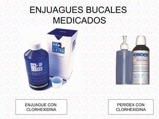 ENJUAGUES BUCALES
     MEDICADOS




ENJUAGUE CON    PERIDEX CON
 CLORHEXIDINA   CLORHEXIDINA
 