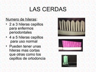 LAS CERDAS
Numero de hileras:
• 2 a 3 hileras cepillos
  para enfermos
  periodontales
• 4 a 5 hileras cepillos
   para uso normal
• Pueden tener unas
  hileras mas cortas
  que otras como los
  cepillos de ortodoncia
 