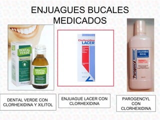 ENJUAGUES BUCALES
                MEDICADOS




 DENTAL VERDE CON        ENJUAGUE LACER CON   PAROGENCYL
CLORHEXIDINA Y XILITOL      CLORHEXIDINA          CON
                                              CLORHEXIDINA
 