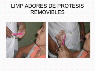 LIMPIADORES DE PROTESIS
       REMOVIBLES
 