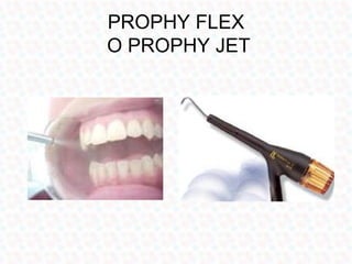 PROPHY FLEX
O PROPHY JET
 