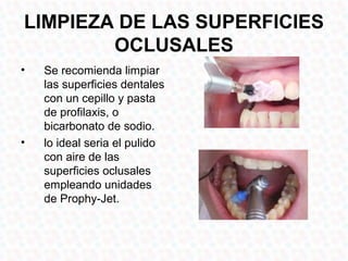 LIMPIEZA DE LAS SUPERFICIES
        OCLUSALES
•   Se recomienda limpiar
    las superficies dentales
    con un cepillo y pasta
    de profilaxis, o
    bicarbonato de sodio.
•   lo ideal seria el pulido
    con aire de las
    superficies oclusales
    empleando unidades
    de Prophy-Jet.
 