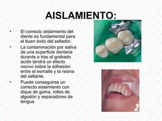 AISLAMIENTO:
•   El correcto aislamiento del
    diente es fundamental para
    el buen éxito del sellador.
•   La contaminación por saliva
    de una superficie dentaria
    durante o tras el grabado
    acido tendrá un efecto
    nocivo sobre la adhesión
    entre el esmalte y la resina
    del sellante.
•   Puede conseguirse un
    correcto aislamiento con
    dique de goma, rollos de
    algodón y separadores de
    lengua.
 