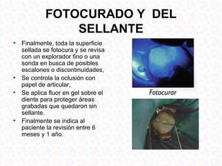 FOTOCURADO Y DEL
               SELLANTE
• Finalmente, toda la superficie
  sellada se fotocura y se revisa
  con un explorador fino o una
  sonda en busca de posibles
  escalones o discontinuidades,
• Se controla la oclusión con
  papel de articular,
• Se aplica fluor en gel sobre el
  diente para proteger áreas
  grabadas que quedaron sin
  sellante.
• Finalmente se indica al
  paciente la revisión entre 6
  meses y 1 año.
 