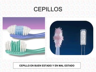 CEPILLOS




CEPILLO EN BUEN ESTADO Y EN MAL ESTADO
 