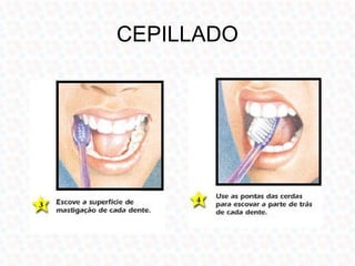 CEPILLADO
 