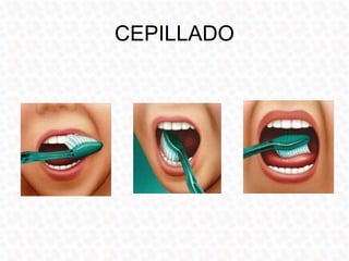CEPILLADO
 