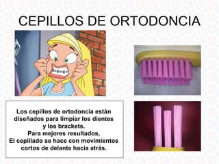 CEPILLOS DE ORTODONCIA




   Los cepillos de ortodoncia están
 diseñados para limpiar los dientes
            y los brackets.
      Para mejores resultados,
El cepillado se hace con movimientos
    cortos de delante hacia atrás.
 