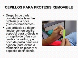 CEPILLOS PARA PROTESIS REMOVIBLE

• Después de cada
  comida debe lavar las
  prótesis y la boca
  (dientes remanentes).
• Las prótesis se deben
  limpiar con un cepillo
  especial para prótesis o
  un cepillo de uñas con
  cerdas de nailon, y un
  poco de pasta dentífrica
  o jabón, para evitar la
  formación de placa y el
  depósito de tinciones.
 