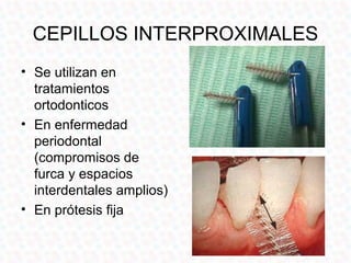 CEPILLOS INTERPROXIMALES
• Se utilizan en
  tratamientos
  ortodonticos
• En enfermedad
  periodontal
  (compromisos de
  furca y espacios
  interdentales amplios)
• En prótesis fija
 