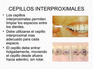 CEPILLOS INTERPROXIMALES
• Los cepillos
  interproximales permiten
  limpiar los espacios entre
  los dientes.
• Debe utilizarse el cepillo
  interproximal mas
  adecuado para cada
  espacio.
• El cepillo debe entrar
  holgadamente, moviendo
  el cepillo desde afuera
  hacia adentro, sin rotar.
 