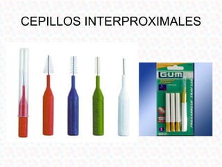 CEPILLOS INTERPROXIMALES
 