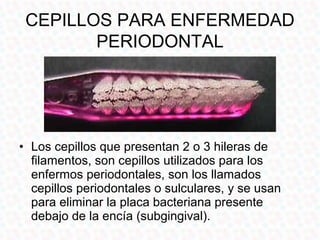 CEPILLOS PARA ENFERMEDAD
        PERIODONTAL




• Los cepillos que presentan 2 o 3 hileras de
  filamentos, son cepillos utilizados para los
  enfermos periodontales, son los llamados
  cepillos periodontales o sulculares, y se usan
  para eliminar la placa bacteriana presente
  debajo de la encía (subgingival).
 