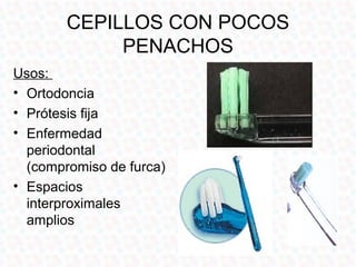 CEPILLOS CON POCOS
             PENACHOS
Usos:
• Ortodoncia
• Prótesis fija
• Enfermedad
  periodontal
  (compromiso de furca)
• Espacios
  interproximales
  amplios
 