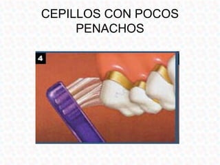 CEPILLOS CON POCOS
     PENACHOS
 
