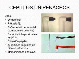 CEPILLOS UNIPENACHOS
Usos:
• Ortodoncia
• Prótesis fija
• Enfermedad periodontal
  (compromiso de furca)
• Espacios interproximales
  amplios
• Recesión papilar
• superficies linguales de
  dientes inferiores
• Malposiciones dentales
 