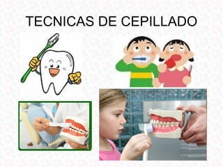 TECNICAS DE CEPILLADO
 