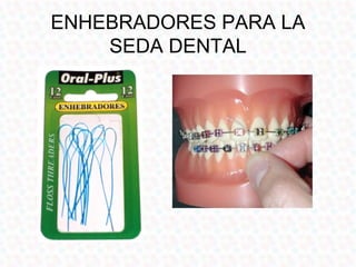 CREMAS DENTALES
Medicadas:

• Para dientes
  sensibles
• Para enfermedades
  de las encías como
  gingivitis o
  periodont...