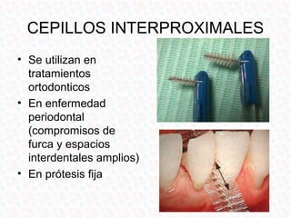 CEPILLOS INTERPROXIMALES
• Los cepillos
  interproximales permiten
  limpiar los espacios entre
  los dientes.
• Debe util...