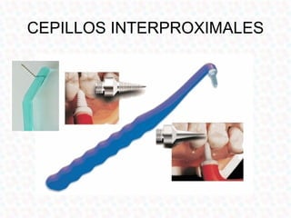 CEPILLOS INTERPROXIMALES
 