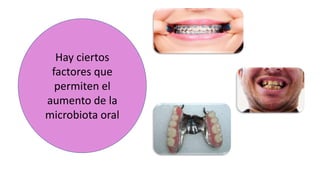 Hay ciertos
factores que
permiten el
aumento de la
microbiota oral
 