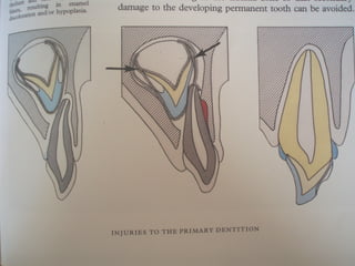 Odontologikh exetash