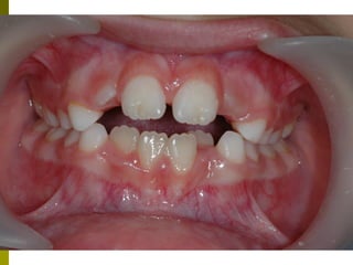 Odontologikh exetash