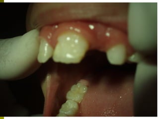 Odontologikh exetash