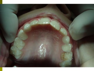 Odontologikh exetash