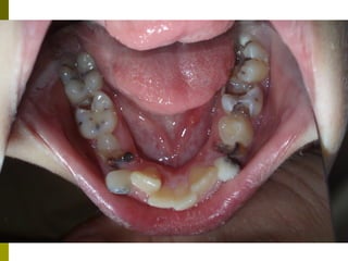 Odontologikh exetash