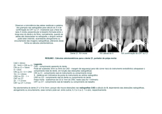 Observar a coincidência das aletas vestibular e palatina
   dos grampos nas radiografias para cálculo do X e de
  confirmação do CRT ou CT, mostrando que o feixe de
 raios X incidiu perpendicular à bissetriz formada entre o
longo eixo do dente e do filme, normalmente, quando as
  aletas são dissociadas na radiografia, o ângulo vertical
     pode estar indevido, acarretando alongamento ou
encurtamento das imagens radiográficas, alterando desta
            forma os cálculos odontométricos.




                                                               Dente 21, RX inicial             RX cálculo do X         RX confirmação do CRT ou CT

                                    RESUMO - Cálculos odontométricos para o dente 21, portador de polpa morta:

CAD = 22mm
                       Legenda:
22 - 3mm = CRI ou CI
                       CAD - comprimento aparente do dente
CRI ou CI = 19mm
                       Pode ser subtraído 3mm ou 5mm do CAD - margem de segurança para não correr risco do instrumento endodôntico ultrapassar o
X = 3mm
                       comprimento total de dente, em função das distorções radiográficas
CRI ou CI + X = CRD
                       CRI ou CI - comprimento real do instrumento ou comprimento inicial
19 + 3 = 22mm
                       X - distância em milímetros da ponta do instrumento ao vértice radiográfico
CRD ou CD - 1 =
                       CRD ou CD - comprimento real do dente ou comprimento do dente
CRT ou CT
                       Polpa morta - subtraímos de 0,5 à 1mm do CRD, neste caso foi 1 milímetro
22 - 1 = 21mm
                       CRT ou CT - comprimento real de trabalho ou comprimento de trabalho
CRT ou CT = 21mm

Na odontometria do dente 21 o X foi 3mm, porque não houve distorções nas radiografias CAD e cálculo do X, dependendo das distorções radiográficas,
alongamento ou encurtamento, esse número pode ser, entre outros, 6, 5 e 4 ou 2, 1 e zero, respectivamente.
 