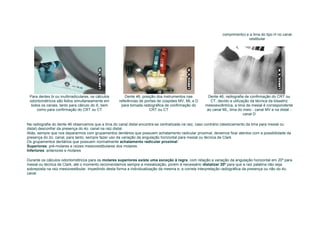 comprimento) e a lima do tipo H no canal
                                                                                                                             vestibular




 Para dentes bi ou multirradiculares, os cálculos       Dente 46, posição dos instrumentos nas         Dente 46, radiografia de confirmação do CRT ou
 odontométricos são feitos simultaneamente em       referências de pontas de cúspides MV, ML e D        CT, devido a utilização da técnica da bissetriz
  todos os canais, tanto para cálculo do X, bem      para tomada radiográfica de confirmação do      mesioexcêntrica, a lima da mesial é correspondente
     como para confirmação do CRT ou CT                               CRT ou CT                       ao canal ML, lima do meio - canal MV e na distal -
                                                                                                                            canal D

Na radiografia do dente 46 observamos que a lima do canal distal encontra-se centralizada na raiz, caso contrário (deslocamento da lima para mesial ou
distal) desconfiar da presença do 4o. canal na raiz distal.
Aliás, sempre que nos depararmos com grupamentos dentários que possuem achatamento radicular proximal, devemos ficar atentos com a possibilidade da
presença do 2o. canal, para tanto, sempre fazer uso da variação da angulação horizontal para mesial ou técnica de Clark.
Os grupamentos dentários que possuem normalmente achatamento radicular proximal:
Superiores: pré-molares e raízes mesiovestibulares dos molares.
Inferiores: anteriores e molares

Durante os cálculos odontométricos para os molares superiores existe uma exceção à regra, com relação a variação da angulação horizontal em 20º para
mesial ou técnica de Clark, até o momento recomendamos sempre a mesialização, porém é necessário distalizar 20º para que a raiz palatina não seja
sobreposta na raiz mesiovestibular, impedindo desta forma a individualização da mesma e, a correta interpretação radiográfica da presença ou não do 4o.
canal.
 