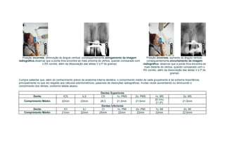 Posição incorreta, diminuição do ângulo vertical, consequentemente,alongamento da imagem          Posição incorreta, aumento do ângulo vertical,
radiográfica,observar que a ponta lima encontra-se mais próxima do vértice, quando comparado com      consequentemente,encurtamento da imagem
                   o RX correto, além da dissociação das aletas V e P do grampo                    radiográfica, observar que a ponta lima encontra-se
                                                                                                    mais distante do vértice, quando comparado com o
                                                                                                   RX correto, além da dissociação das aletas V e P do
                                                                                                                          grampo

Cumpre salientar que, além do conhecimento prévio da anatomia interna dentária, o comprimento médio de cada grupamento é de extrema importância,
principalmente no que diz respeito aos cálculos odontométricos, passíveis de distorções radiograficas, muitas vezes aumentando ou diminuindo o
comprimento dos dentes, conforme tabela abaixo:

                                                                 Dentes Superiores
           Dente:                  ICS            ILS            CS         1o. PMS         2o. PMS         1o. MS                 2o. MS
                                                                                                            20 (Vs)
    Comprimento Médio:            22mm           23mm            26,5         21,5mm         21,5mm                                21,5mm
                                                                                                            21 (P)
                                                                 Dentes Inferiores
          Dente:                   ICI            ILI             CI         1o. PMI         2o. PMI         1o. MI                 2o. MI
    Comprimento Médio:            21mm           22mm           25mm          22mm            22mm           22mm                  22,5mm
 