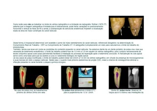 Outra razão para não se trabalhar no limite do vértice radiográfico é a limitação da radiografia. Rothier (1975-77)
salienta que a imagem radiográfica é limitada pois é bidimensional, pode haver variações no posicionamento
horizontal e vertical do feixe de Rx e ainda, a sobreposição de estruturas anatômicas impedem a localização
exata da área de maior constrição do canal radicular.




Desta forma, é impossível determinar com exatidão o ponto de maior estreitamento do canal radicular, referencial obrigatório na determinação do
Comprimento Real de Trabalho - CRT ou Comprimento de Trabalho CT. A radiografia é simplesmente um meio para calcularmos o limite de trabalho do
endodontista.
Também, temos que levar em conta as condições do conteúdo presente no canal radicular. Se estamos diante de um dente portador de polpa viva, mas que
necessita de tratamento endodôntico, o limite de trabalho poderá ficar de 1,0 mm a 1,5 mm aquém do vértice radiográfico, pois o próprio remanescente de
tecido conjuntivo apical (coto pulpo-periodontal) facilitará a instalação do processo de reparação após o tratamento concluído. A manutenção do coto apical
serve como uma base para que se acelere a cura e o selamento biológico da região apical.
Já nos casos de polpa mortificada, o limite de trabalho poderá distar de 0,5mm a 1,0 mm do vértice radiográfico, em virtude da presença de microorganismos
e suas toxinas em todo o espaço radicular. Neste caso, o quanto mais próximo estivermos da junção CDC, maior a chance de conseguirmos eliminar a
infecção presente no canal durante o preparo químico-cirúrgico.




 No caso de polpa viva, se trabalharmos                     Na polpa viva adotaremos o limite (CT)                       Dente 45, polpa morta, observar os
   próximo ao vértice (linha com seta                        para a pulpectomia de 1,0 à 1,5mm                        traços azul e o branco nas imediações da
 