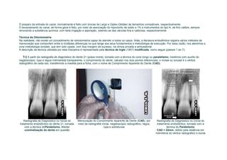O preparo da entrada do canal, normalmente é feito com brocas de Largo e Gates-Glidden de tamanhos compatíveis, respectivamente.
O esvaziamento do canal, de forma geral é feito, por meio da associação do hipoclorito de sódio a 1% e instrumentos do tipo K, de fino calibre, sempre
renovando a substância química, com farta irrigação e aspiração, valendo-se das cânulas fina e calibrosa, respectivamente.

Técnica da Odontometria
Na realidade, não existe um procedimento de odontometria capaz de atender a todos os casos. Aliás, a literatura endodôntica registra vários métodos de
mensuração que comportam entre si múltiplas diferenças no que tange aos seus fundamentos e metodologia de execução. Por essa razão, nos ateremos a
uma metodologia simples, que tem sido usada, com boa margem de sucesso, na clínica privada e ambulatorial.
A descrição da técnica utilizada por esta Disciplina é representada pela técnica de Ingle (1957) modificada, como segue (passos 1 ao 7):

   1-) A partir da radiografia de diagnóstico do dente 21 (polpa morta), tomada com a técnica do cone longo ou paralelismo, medimos com auxílio do
negatoscópio, lupa e régua milimetrada transparente, o comprimento do dente, calcado nos dois pontos referenciais: o incisal ou oclusal e o vértice
radiográfico de cada raiz, transferindo a medida para a ficha, com o nome de Comprimento Aparente do Dente (CAD).




   Radiografia de Diagnóstico ou Inicial do     Mensuração do Comprimento Aparente de Dente (CAD), por           Radiografia de Diagnóstico ou Inicial do
tratamento endodôntico do dente 21, tomada      meio da radiografia inicial, negatoscópio radiográfico, régua,    tratamento endodôntico, tomada com a
    com a técnica doParalelismo. Manter                               lupa e sobreluvas                                   técnica do Paralelismo
    acentralização do dente em questão                                                                           CAD = 22mm, obtido pela distância em
                                                                                                                 milímetros do vértice radiográfico e borda
 