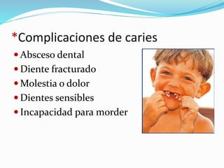 *Complicaciones de caries
 Absceso dental
 Diente fracturado
 Molestia o dolor
 Dientes sensibles
 Incapacidad para morder
 