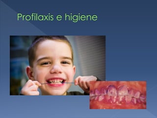 Profilaxis e higiene
 