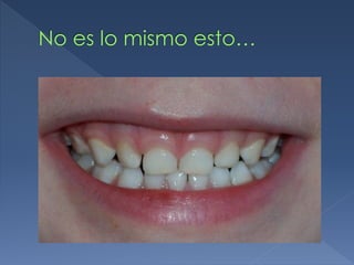 No es lo mismo esto…
 