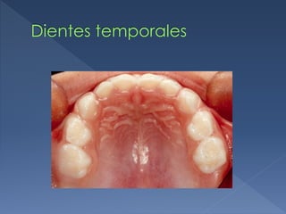 Dientes temporales
 