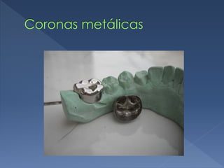 Coronas metálicas
 