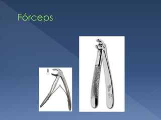 Fórceps
 