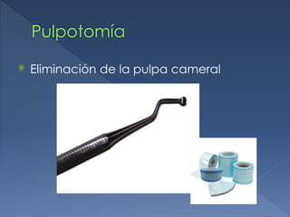 Pulpotomía
⦿ Eliminación de la pulpa cameral
 