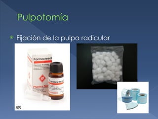 Pulpotomía
⦿ Fijación de la pulpa radicular
4%
 