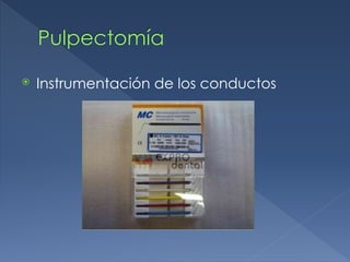 Pulpectomía
⦿ Instrumentación de los conductos
 
