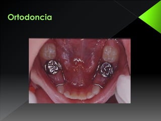 Ortodoncia
 